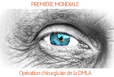 Première mondiale : Des médecins restaurent la vision de deux personnes atteintes de DMLA