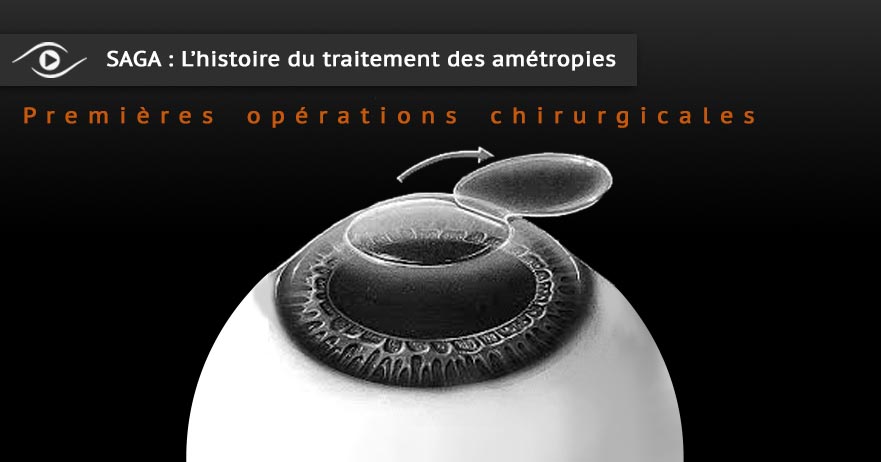 les connaissances ophtalmologiques et optiques du XXIéme siécle