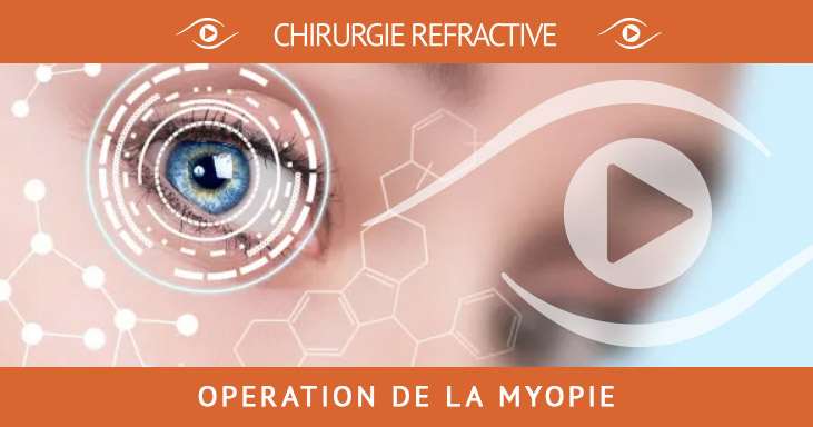 Myopie et chirurgie refractive