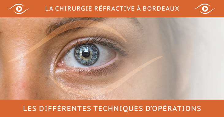 La chirurgie réfractive à Bordeaux oeil opéré La chirurgie réfractive à Bordeaux oeil opéré
