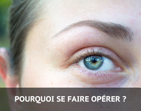 Pourquoi se faire opérer ?