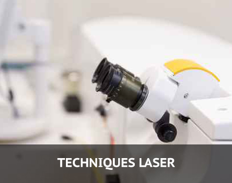 Image illustrant les différentes techniques laser de chirurgie refractive.